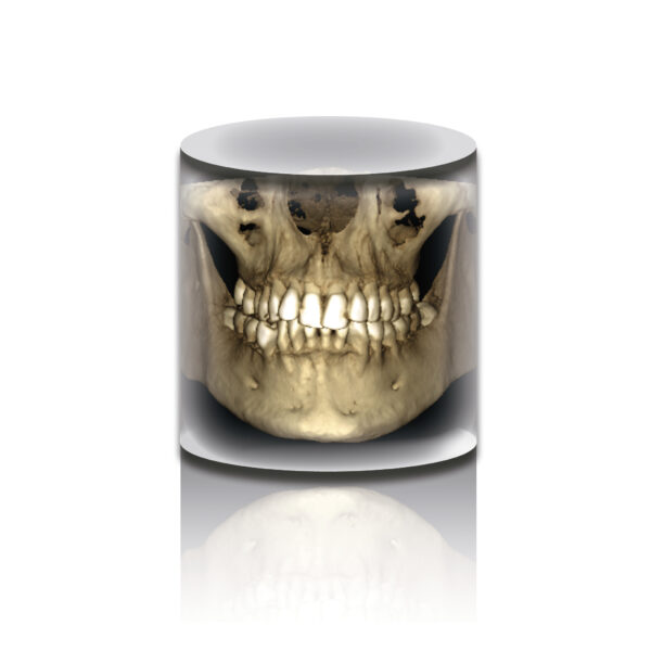 Planmeca Viso G1 obrazowanie CBCT - obrazek 3