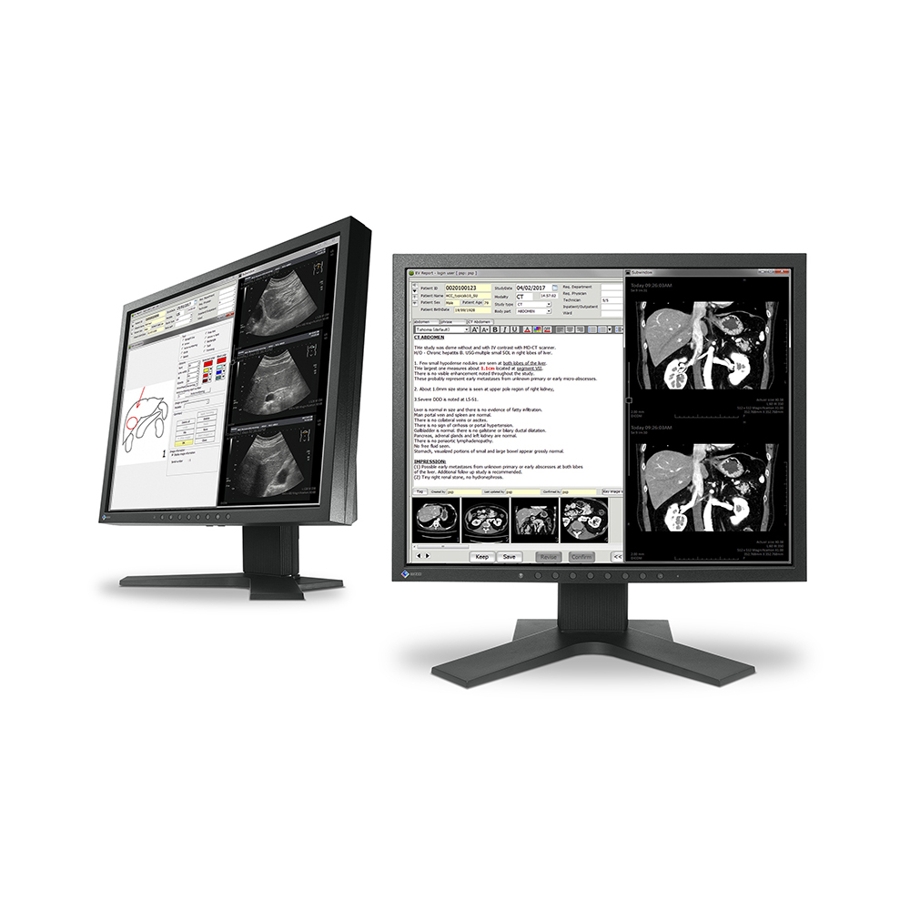 Monitor stomatologiczny Eizo RadiForce MX194 - obrazek 2