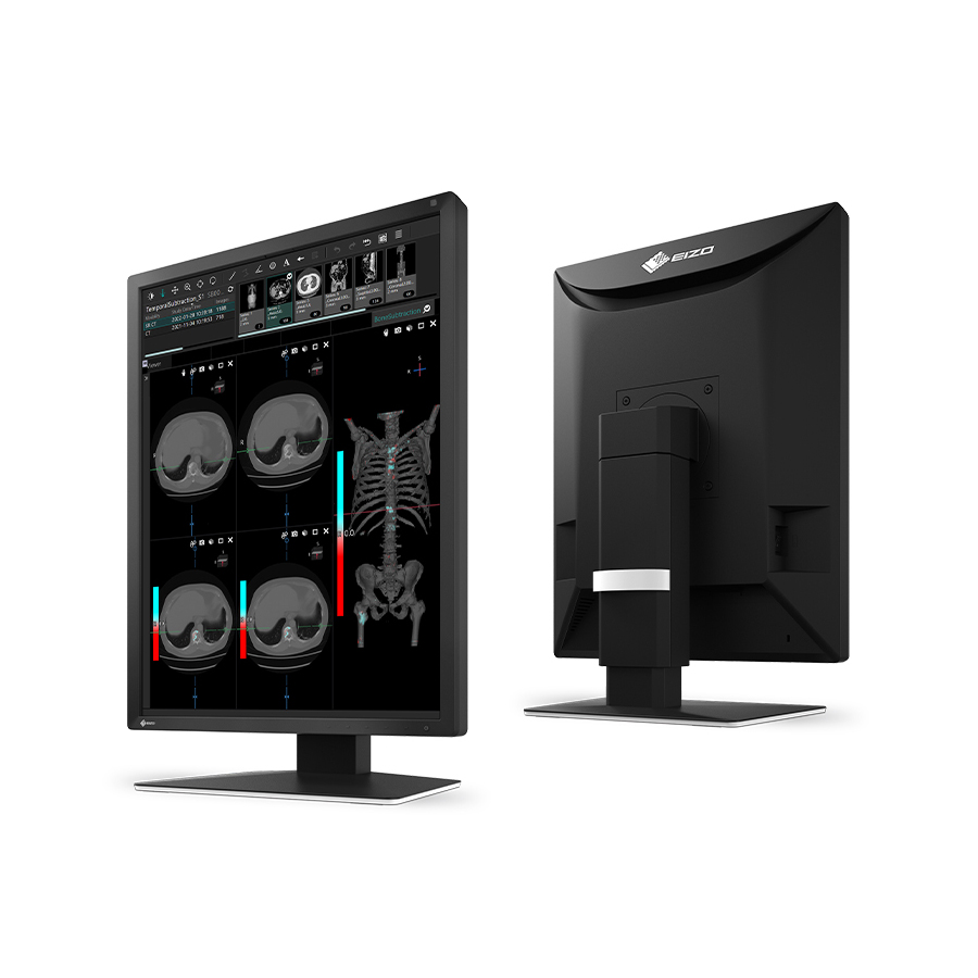 Monitor stomatologiczny Eizo RadiForce MX217 - obrazek 2
