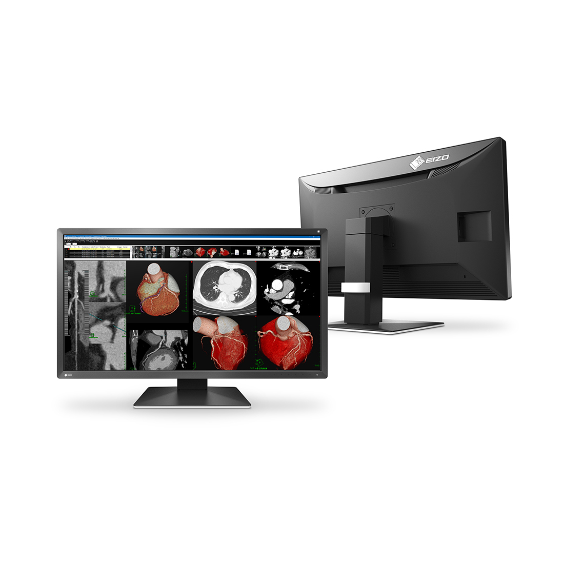 Monitor stomatologiczny Eizo RadiForce MX317W - obrazek 2