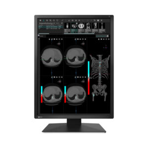 Monitor stomatologiczny Eizo RadiForce MX217