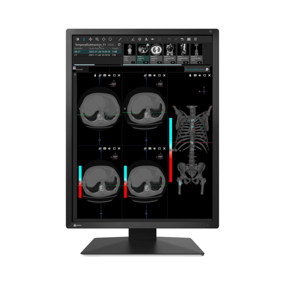 Monitor stomatologiczny Eizo RadiForce MX217