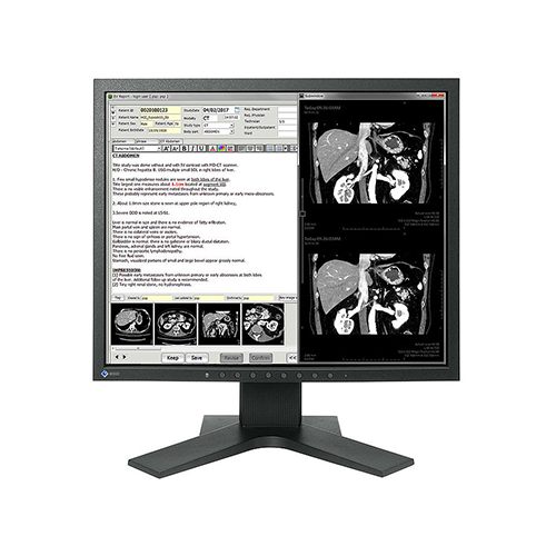 Monitor stomatologiczny Eizo RadiForce MX194