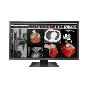 Monitor stomatologiczny Eizo RadiForce MX317W